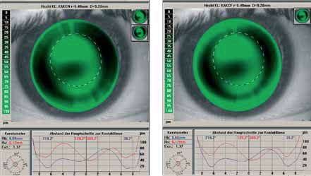 KAKC N r0= 6.40 mm D = 9.20 mm KAKCF r0 = 6.40 mm D= 9.20 mm